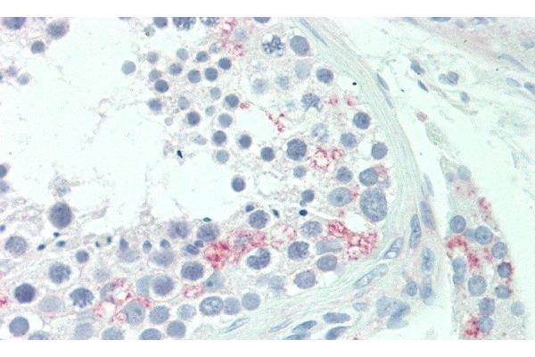 Estradiol antibody