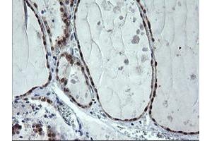 Image no. 2 for anti-Cytidine Monophosphate (UMP-CMP) Kinase 1, Cytosolic (CMPK1) antibody (ABIN1497542) (Cytidine Monophosphate (UMP-CMP) Kinase 1, Cytosolic (CMPK1) antibody)
