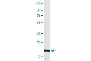 Western Blot detection against Immunogen (20. (TACI antibody  (AA 2-165))