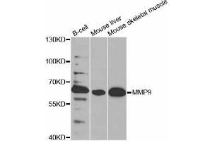 Western blot analysis of extracts of various cell lines, using MMP9 antibody. (MMP 9 antibody)