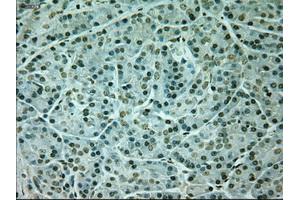 Immunohistochemical staining of paraffin-embedded Kidney tissue using anti-NEUROG1mouse monoclonal antibody. (Neurogenin 1 antibody)