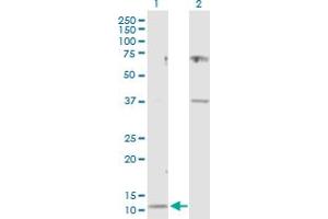 Western Blot analysis of CST3 expression in transfected 293T cell line by CST3 MaxPab polyclonal antibody. (CST3 antibody  (AA 1-146))