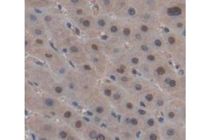Figure. (MTA2 antibody  (AA 1-394))