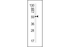 Western blot analysis of FH2 Antibody (C-term) (ABIN651343 and ABIN2840194) in HepG2 cell line lysates (35 μg/lane). (FAAH2 antibody  (C-Term))