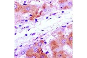 Immunohistochemistry (IHC) image for anti-Ribosomal Protein S7 (RPS7) antibody (ABIN7308296) (RPS7 antibody)