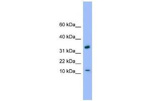 GABARAP antibody used at 0.