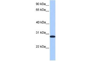 CDKN3 antibody used at 1 ug/ml to detect target protein. (CDKN3 antibody)