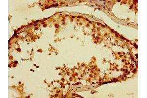 Immunohistochemistry of paraffin-embedded human testis tissue using ABIN7173606 at dilution of 1:100 (TPSB2 antibody  (AA 31-275))