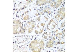 Immunohistochemistry of paraffin-embedded human stomach using RPH3AL antibody. (RPH3AL antibody  (AA 161-315))