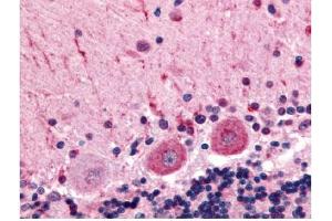 Immunohistochemical staining of human brain (Purkinje Neurons) using anti-CELSR3 antibody (CELSR3 antibody  (C-Term))