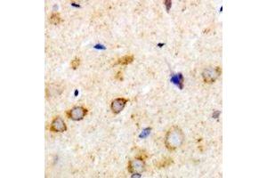 Immunohistochemical analysis of Rabphilin 3A staining in human brain formalin fixed paraffin embedded tissue section. (RPH3A antibody)