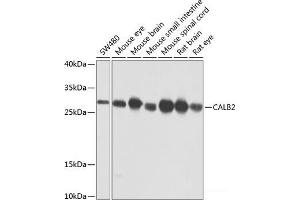 Western blot analysis of extracts of various cell lines using CALB2 Polyclonal Antibody at dilution of 1:1000. (Calretinin antibody)