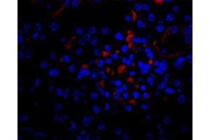 Image no. 1 for anti-Vascular Endothelial Growth Factor A (VEGFA) antibody (ABIN465273) (VEGFA antibody)