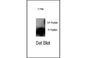 Dot blot analysis of anti-Phospho-cJun-S63 Antibody (ABIN389544 and ABIN2839589) on nitrocellulose membrane. (C-JUN antibody  (pSer63))