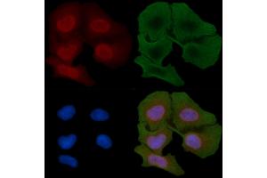 ABIN6259872 and ABIN6266829 staining Hela cells(30 min of UV treatment) by IF/ICC.