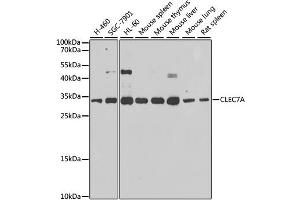Western blot analysis of extracts of various cell lines, using CLEC7A antibody. (CLEC7A antibody)
