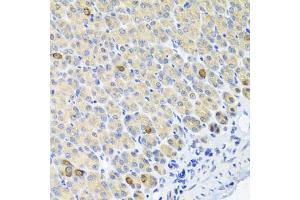 Immunohistochemistry of paraffin-embedded mouse stomach using GLS antibody. (Glutaminase antibody)