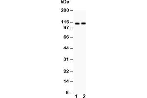 Western blot testing of ATP2A2 antibody and Lane 1:  rat skeletal muscle;  2: mouse skeletal muscle;  Predicted size: 115KD;  Observed size: 115KD (ATP2A2 antibody  (N-Term))