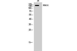 Western Blotting (WB) image for anti-RNA Binding Motif Protein 16 (RBM16) (Internal Region) antibody (ABIN3177165) (RBM16 antibody  (Internal Region))