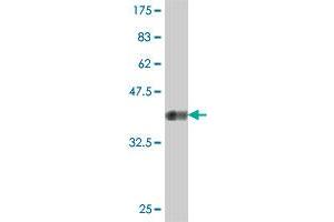 Western Blot detection against Immunogen (37. (PRKRA antibody  (AA 101-200))