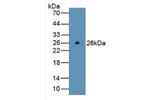 WB of Protein Standard: different control antibodies against Highly purified E. (Bcl-2 ELISA Kit)