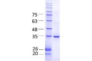 GPD1 (AA 1-349), fraction 15 - 17 (GPD1 Protein (AA 1-349) (Strep Tag))