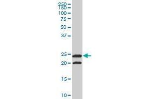 TPI1 monoclonal antibody (M02A), clone 2C3. (TPI1 antibody  (AA 1-249))