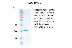 SDS-PAGE (SDS) image for Fibroblast Growth Factor 7 (FGF7) (Active) protein (ABIN5509361) (FGF7 Protein)