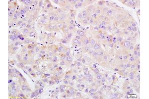Immunohistochemistry (Paraffin-embedded Sections) (IHC (p)) image for anti-WEE1 Homolog (S. Pombe) (WEE1) (pSer642) antibody (ABIN746873)