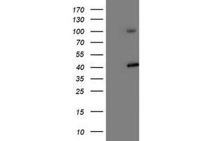 HEK293T cells were transfected with the pCMV6-ENTRY control (Left lane) or pCMV6-ENTRY PSMD2 (Right lane) cDNA for 48 hrs and lysed. (PSMD2 antibody)