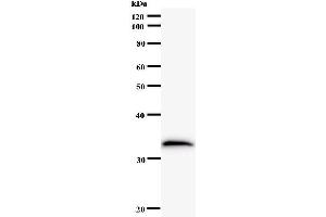 Western Blotting (WB) image for anti-MOB Kinase Activator 2 (MOB2) antibody (ABIN931152) (MOB2 antibody)