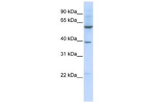 SLC35F3 antibody used at 1 ug/ml to detect target protein. (SLC35F3 antibody  (Middle Region))