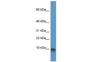 WB Suggested Anti-EGF Antibody Titration:  0. (EGF antibody  (Middle Region))