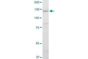 LAMC2 polyclonal antibody (A01), Lot # 051003JC01. (LAMC2 antibody  (AA 1084-1193))