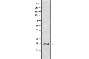 Western blot analysis of CD164L2 using HepG2 whole cell lysates (CD164L2 antibody)