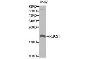 Western Blotting (WB) image for anti-Killer Cell Lectin-Like Receptor Subfamily D, Member 1 (KLRD1) antibody (ABIN1873452) (CD94 antibody)