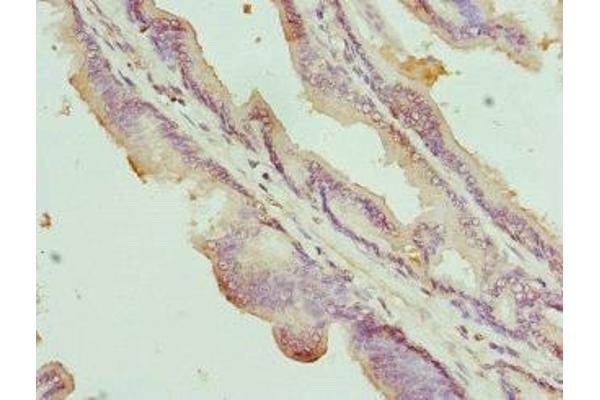NOX5 antibody  (AA 661-765)