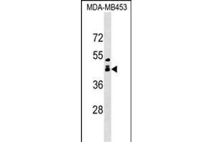 ALX1 Antibody (Center) (ABIN1538707 and ABIN2849356) western blot analysis in MDA-M cell line lysates (35 μg/lane). (ALX1 antibody  (AA 97-122))