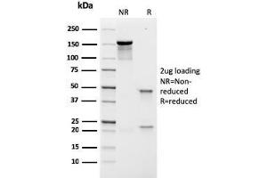 SDS-PAGE Analysis Purified Prolactin Receptor Recombinant Mouse Monoclonal (rPRLR742). (Recombinant Prolactin Receptor antibody)