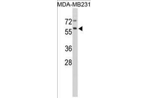 Image no. 1 for anti-Cathepsin F (CTSF) (Middle Region) antibody (ABIN452888) (Cathepsin F antibody  (Middle Region))