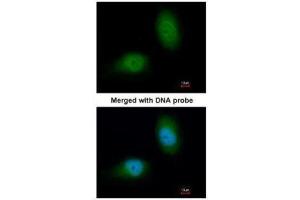 ICC/IF Image Immunofluorescence analysis of paraformaldehyde-fixed HeLa, using HSPB8, antibody at 1:200 dilution. (HSPB8 antibody  (C-Term))