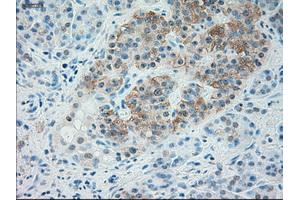 Immunohistochemical staining of paraffin-embedded liver tissue using anti-TRPM4mouse monoclonal antibody. (TRPM4 antibody)