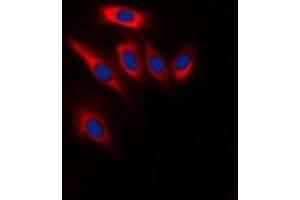 Immunofluorescent analysis of PTEN staining in Hela cells. (PTEN antibody  (C-Term))