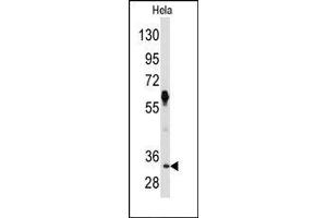 Image no. 1 for anti-Proto-Oncogene Pim-2 (Serine Threonine Kinase) (PIM2) (C-Term) antibody (ABIN360329) (PIM2 antibody  (C-Term))