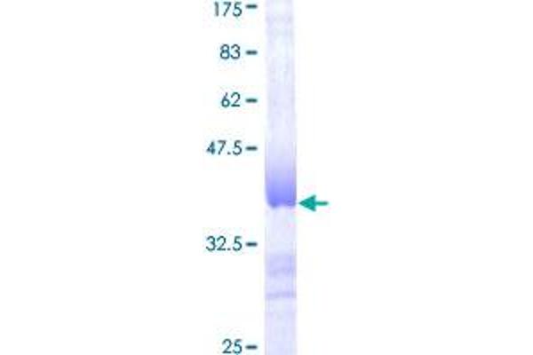 Deoxyguanosine Kinase Protein (DGUOK) (AA 1-89) (GST tag)