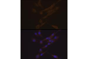 Immunofluorescence analysis of THP-1 and K562 cells using YKL-40/CHI3L1 Rabbit mAb (ABIN7266328) at dilution of 1:100 (40x lens).