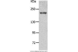 Western blot analysis of Mouse kidney tissue, using NPHS1 Polyclonal Antibody at dilution of 1:700 (Nephrin antibody)