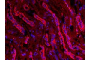 Immunofluorescence (Paraffin-embedded Sections) (IF (p)) image for anti-Aquaporin 2 (Collecting Duct) (AQP2) (AA 171-271) antibody (ABIN707576)