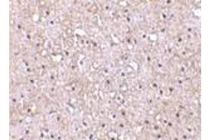 Immunohistochemistry of CTRP5 in human brain tissue with CTRP5 antibody at 10 μg/ml. (CTRP5 antibody  (N-Term))