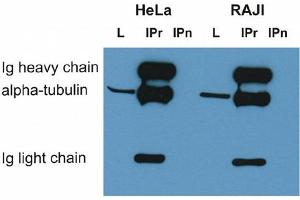Immunoprecipitation of alpha-tubulin from HeLa and RAJI cell lysate by antibody TU-16 and its detection by antibody TU-01 .